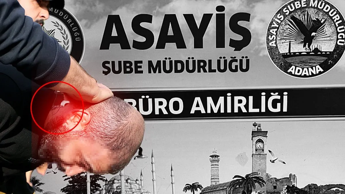 Adana’da kuyumcuyu omzundan ve sırtından vurarak altınları çalmıştı: O detay sayesinde yakalandı!